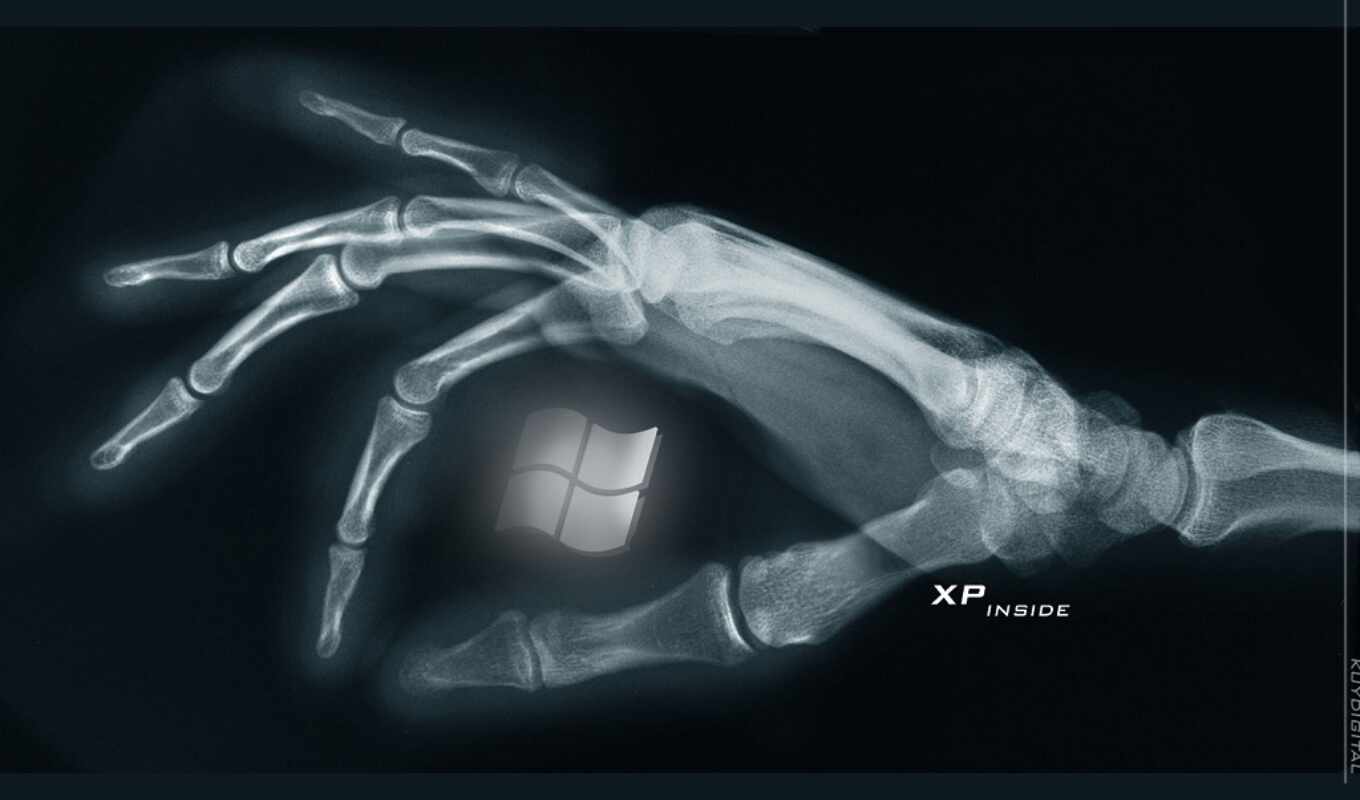 arm, black, bones, x-ray, leg